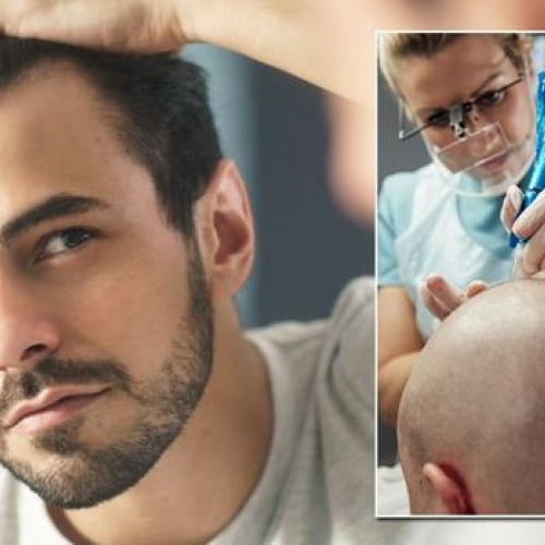 Hair Loss Treatment Specialist in Manchester